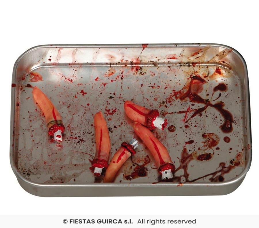 Amputoidut sormet, 5 kpl