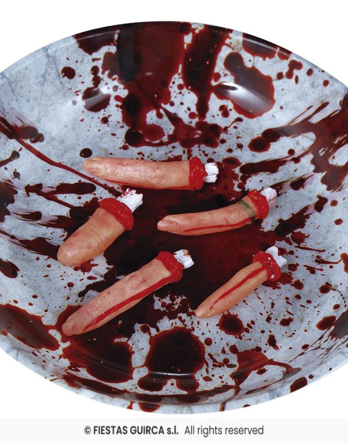 Amputoidut sormet, 5 kpl